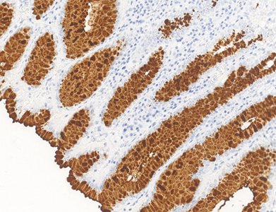 Marquage immunohistochimique anti-MUC5AC — Dartmon