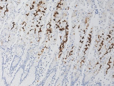 Marquage immunohistochimique anti-MUC6 — Dartmon