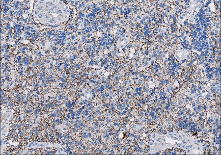 Marquage immunohistochimique anti-Neurofilament — Dartmon