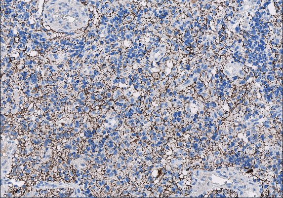 Marquage immunohistochimique anti-Neurofilament — Dartmon