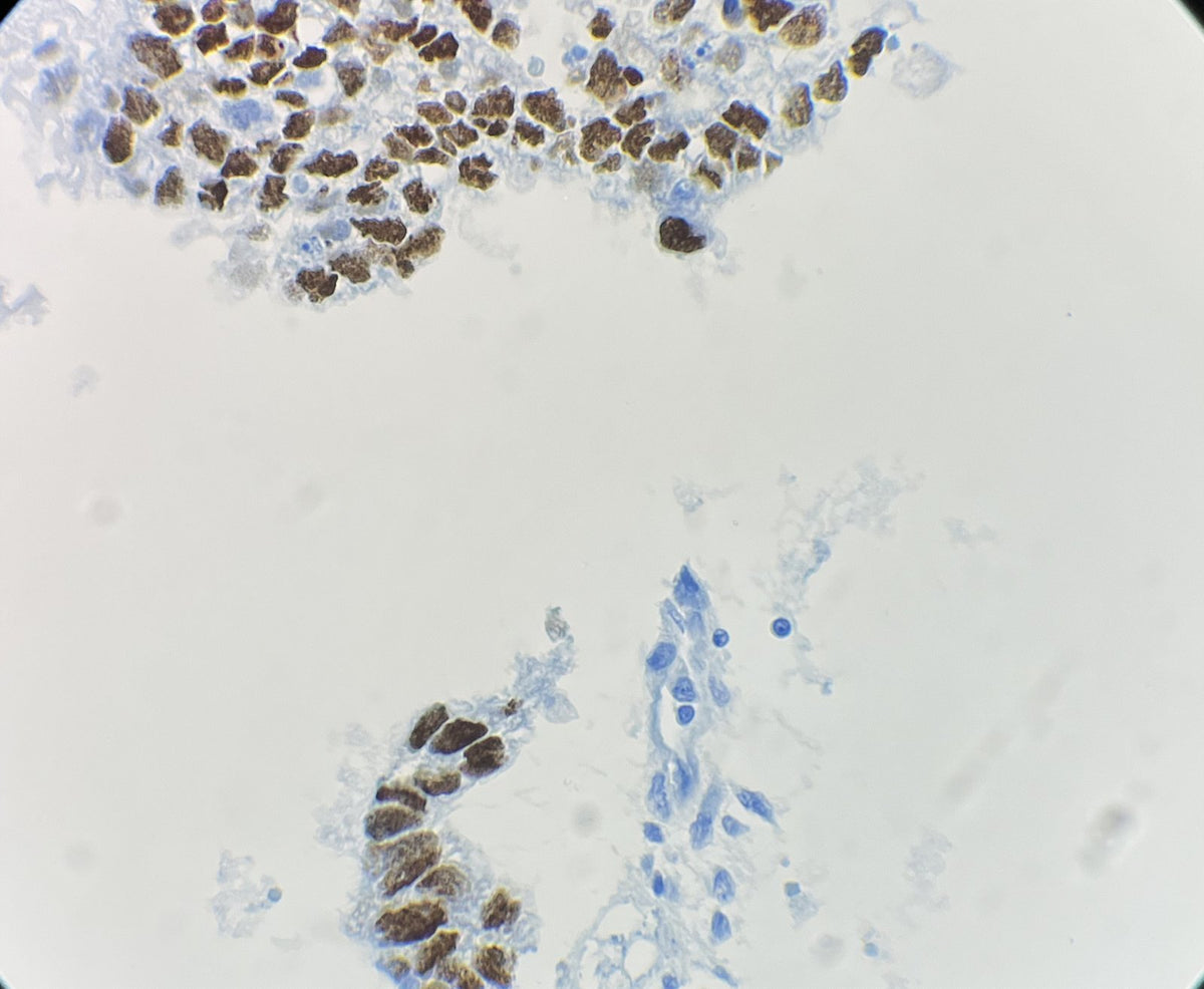 Marquage immunohistochimique anti-Oct3/4 — Dartmon