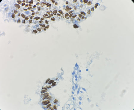 Marquage immunohistochimique anti-Oct3/4 — Dartmon