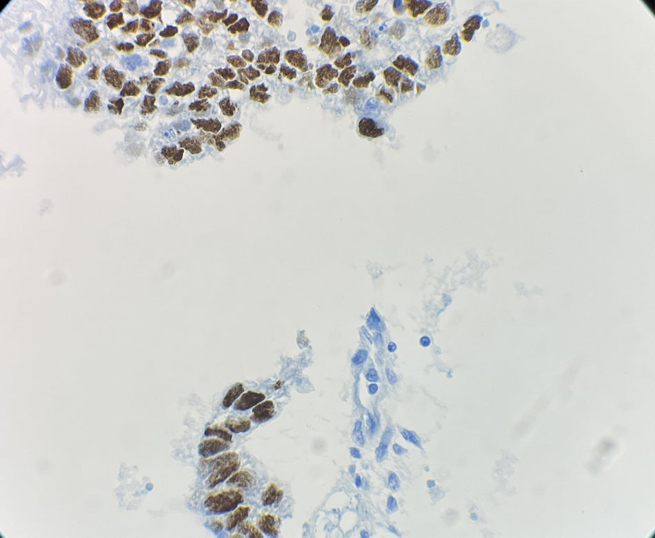 Marquage immunohistochimique anti-Oct3/4 — Dartmon