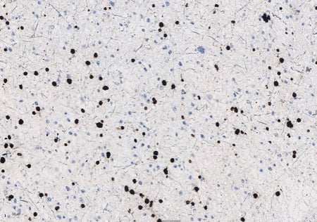 Marquage immunohistochimique anti-Oligo-2 — Dartmon