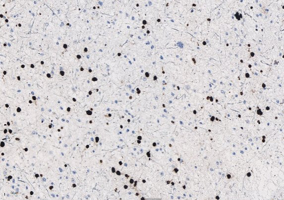 Marquage immunohistochimique anti-Oligo-2 — Dartmon