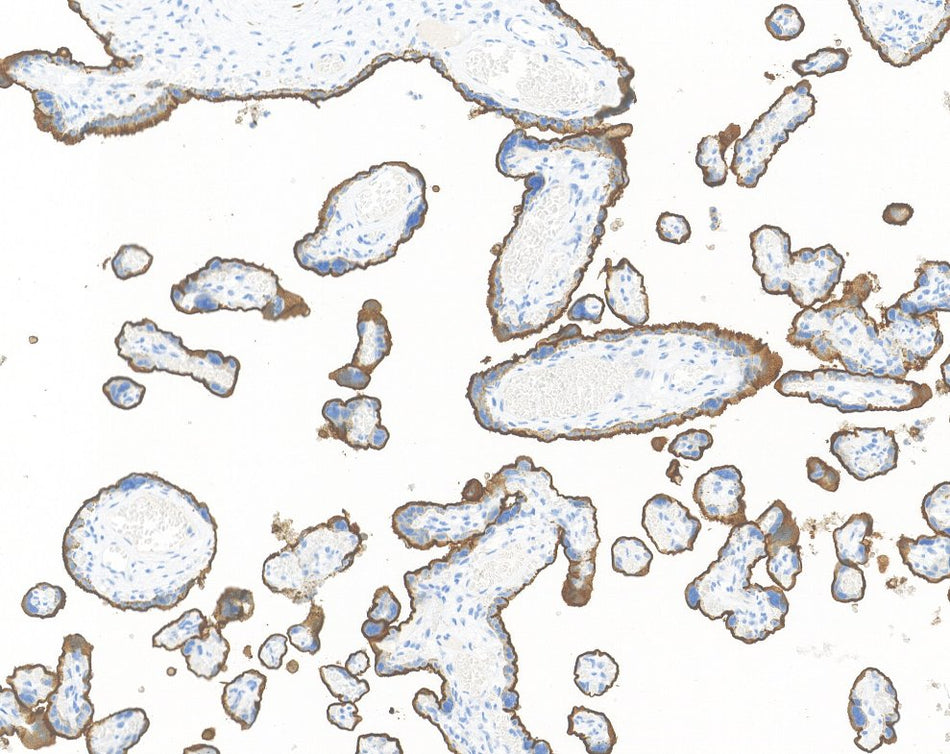 Marquage immunohistochimique anti-PLAP — Dartmon