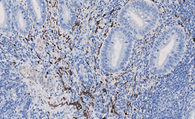 Marquage immunohistochimique anti-PGP 9.5 — Dartmon