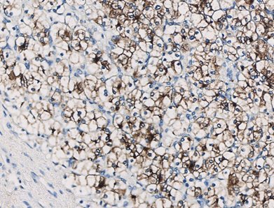 Marquage immunohistochimique anti-RCC — Dartmon