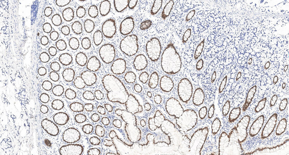 Marquage immunohistochimique anti-SATB2 — Dartmon
