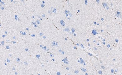 Marquage immunohistochimique anti-Sérotonine — Dartmon