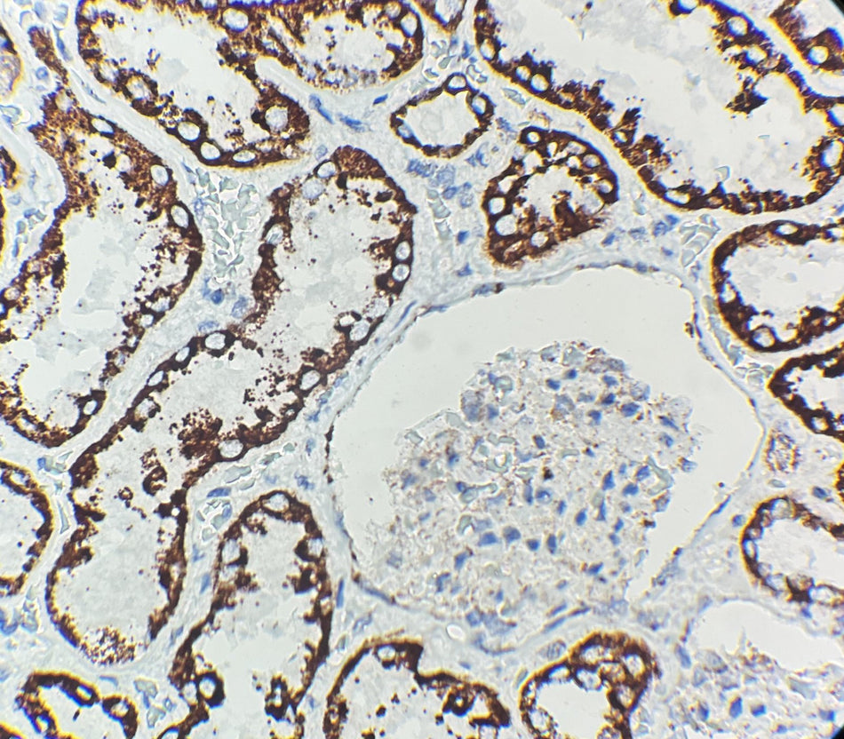 Marquage immunohistochimique anti-STAT6 — Dartmon
