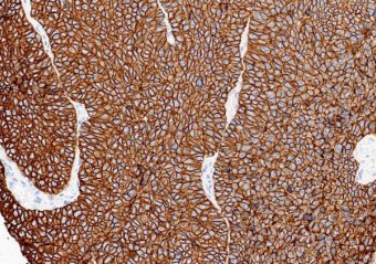 Marquage immunohistochimique anti-TROP2 — Dartmon