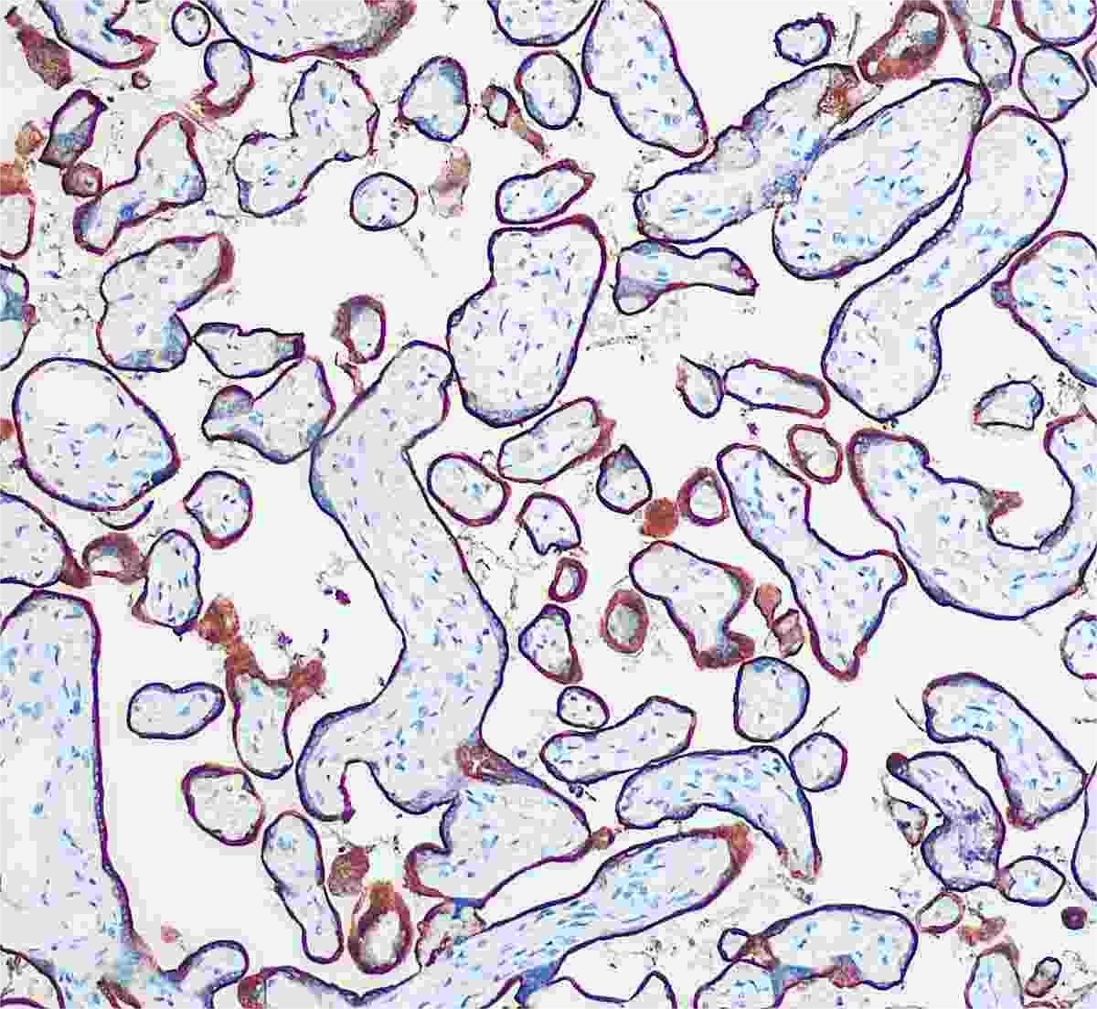Marquage immunohistochimique anti-CD71 — Dartmon