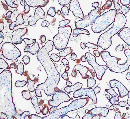 Marquage immunohistochimique anti-CD71 — Dartmon