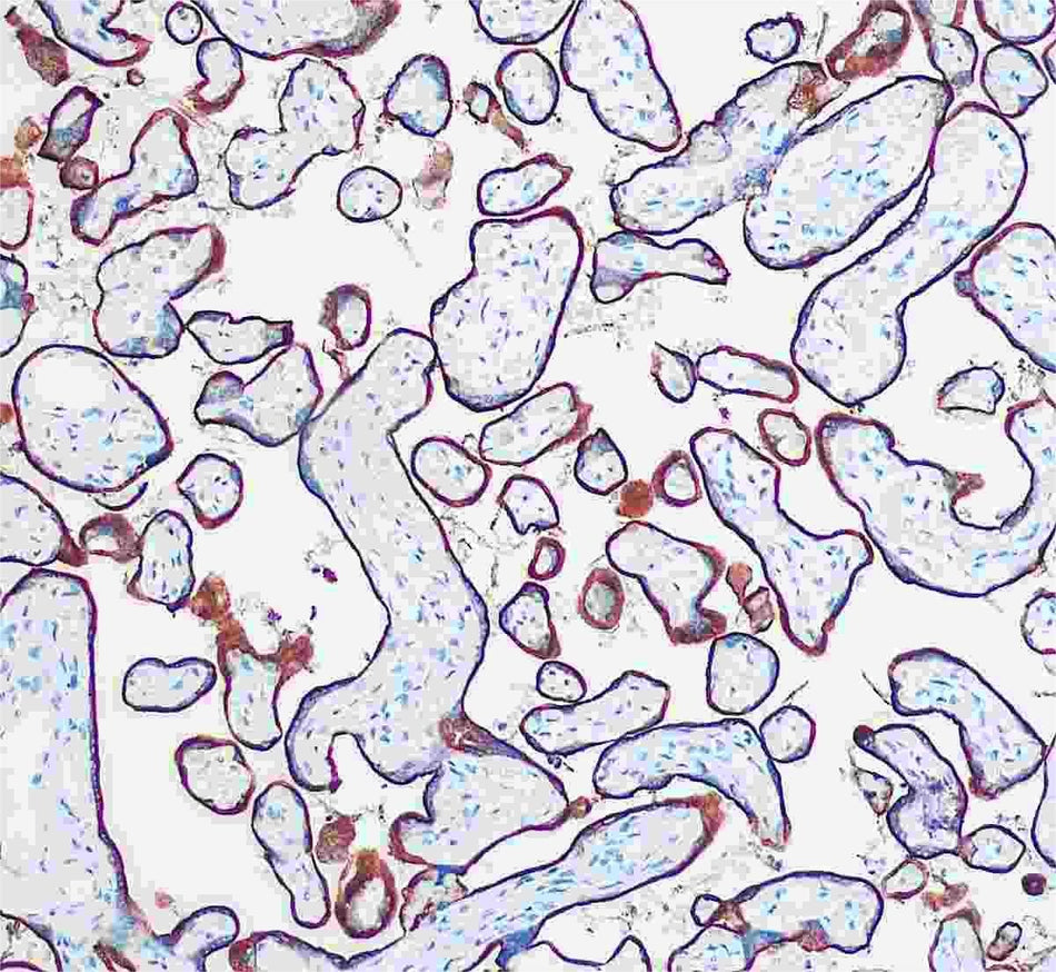Marquage immunohistochimique anti-CD71 — Dartmon