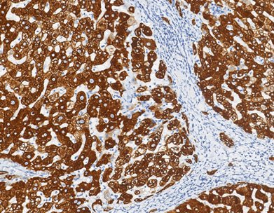 Marquage immunohistochimique anti-CK8 — Dartmon