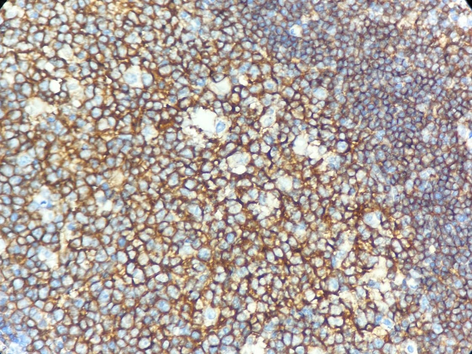 Marquage immunohistochimique anti-CD19 — Dartmon