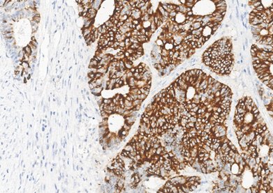 Marquage immunohistochimique anti-MUC2 — Dartmon