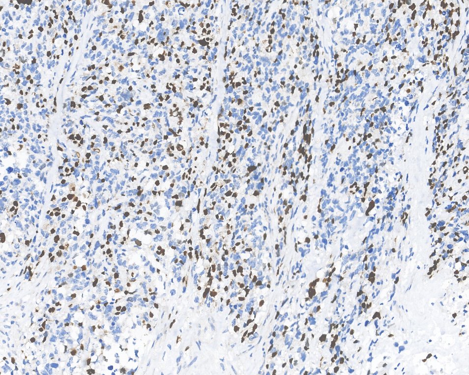 Marquage immunohistochimique anti-MyoG — Dartmon