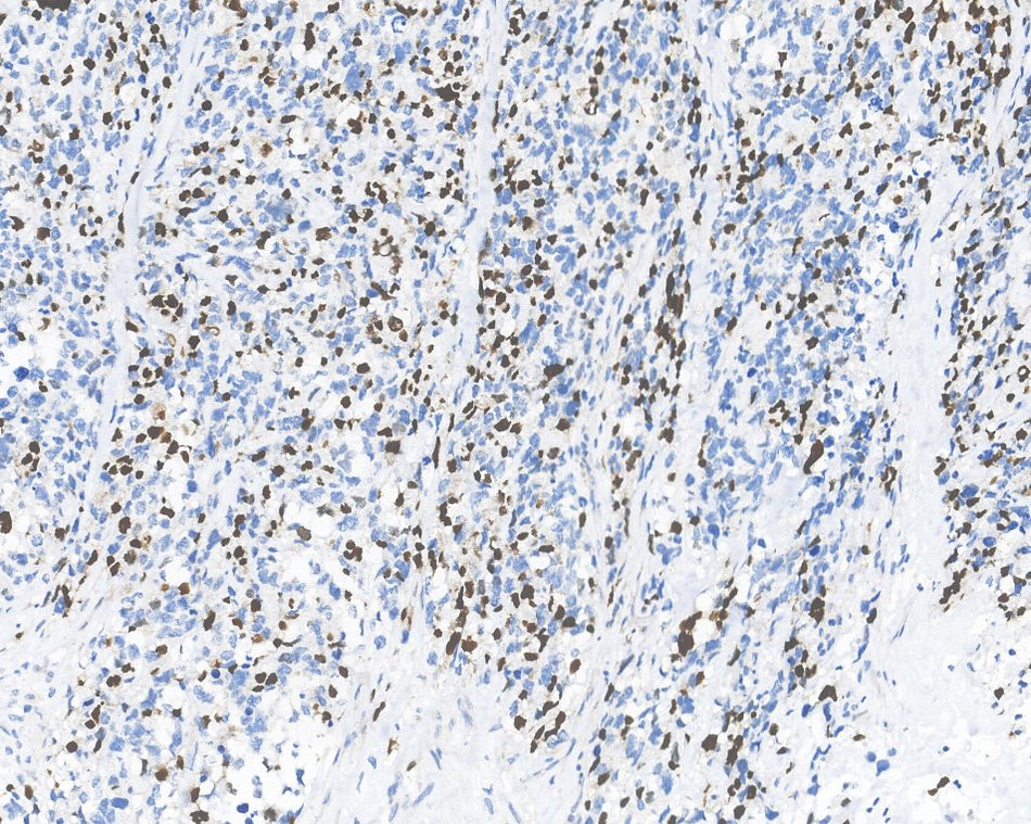 Marquage immunohistochimique anti-MyoG — Dartmon