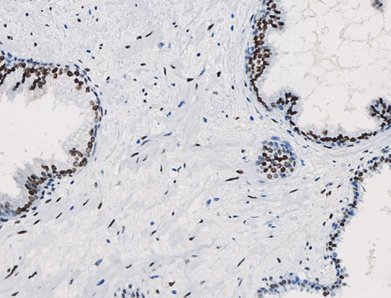 Marquage immunohistochimique anti-RA — Dartmon