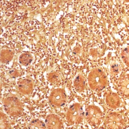 Kit de Grimelius