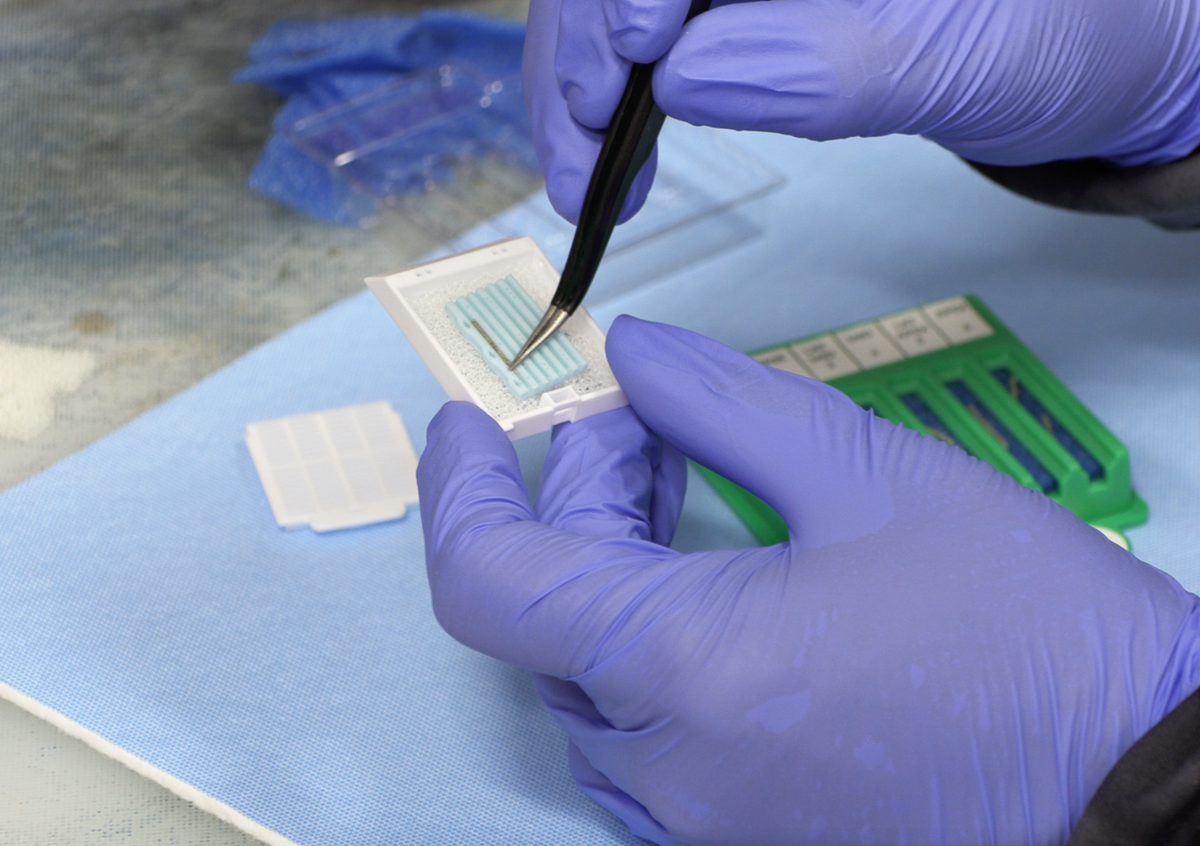 Technicien déposant des carottes de biopsie prostatique dans un BxChip® à la macroscopie