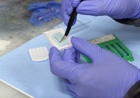 Technicien déposant des carottes de biopsie prostatique dans un BxChip® à la macroscopie