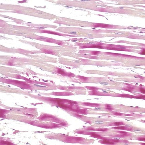 Kit H.B.F.P.