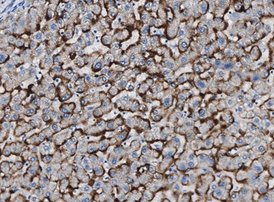 Marquage immunohistochimique anti-HBsAg — Dartmon