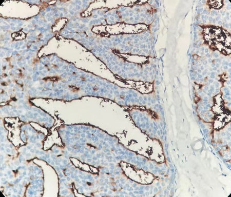 Marquage immunohistochimique anti-EMA — Dartmon