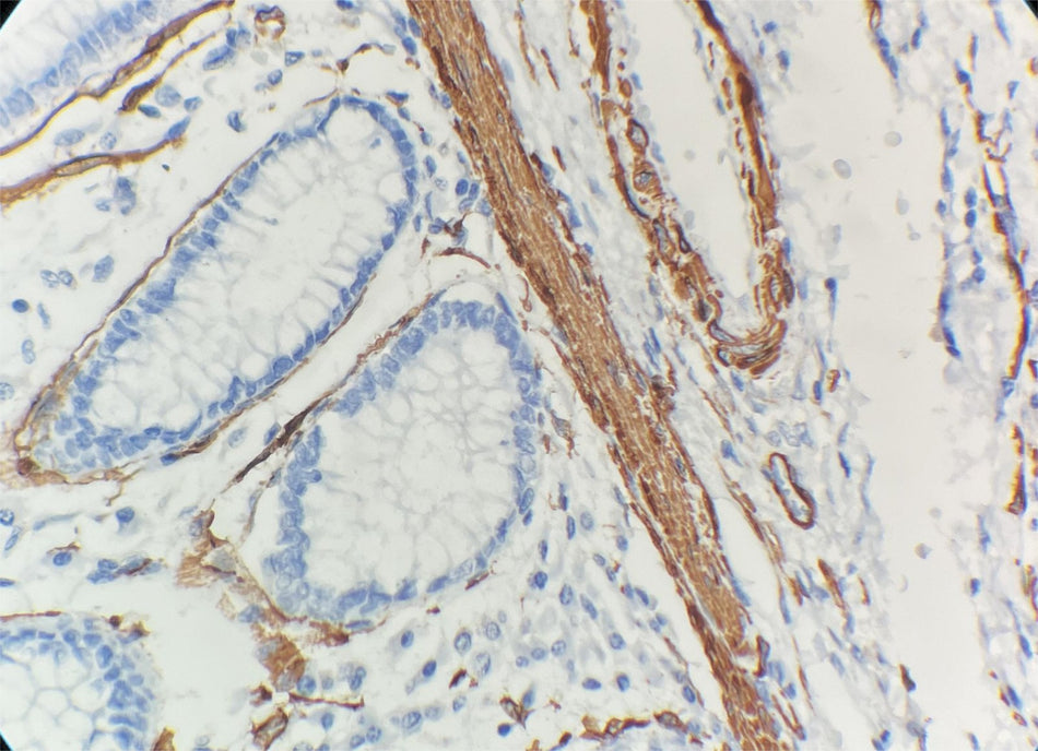 Marquage immunohistochimique anti-SMA — Dartmon