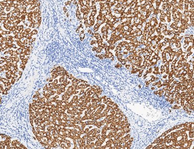 Marquage immunohistochimique anti-Hepatocyte — Dartmon