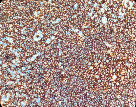 Marquage immunohistochimique anti-CD45 — Dartmon