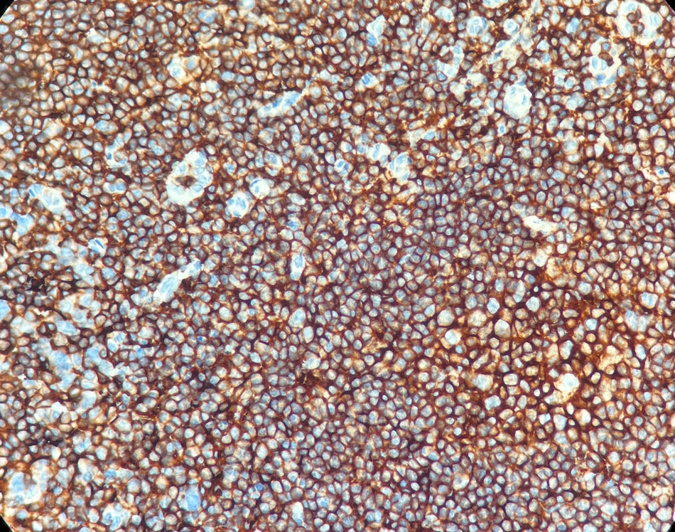 Marquage immunohistochimique anti-CD45 — Dartmon
