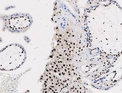 Marquage immunohistochimique anti-p57 — Dartmon