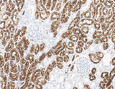 Marquage immunohistochimique anti-CD15 — Dartmon