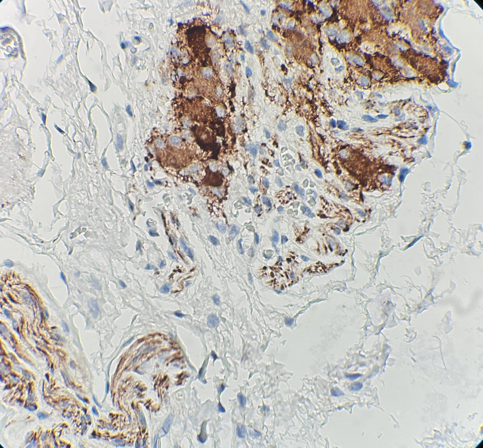 Marquage immunohistochimique anti-NSE — Dartmon
