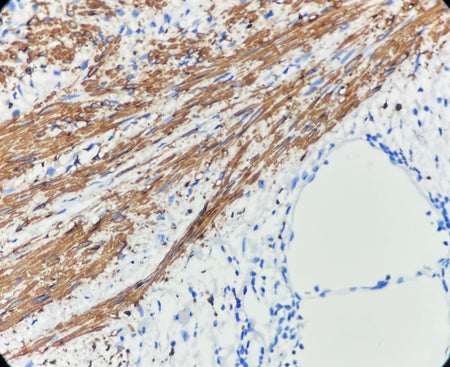 Marquage immunohistochimique anti-CALD1 — Dartmon