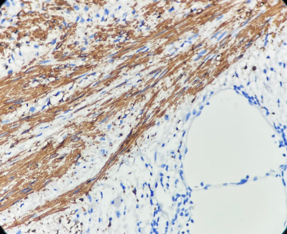 Marquage immunohistochimique anti-CALD1 — Dartmon