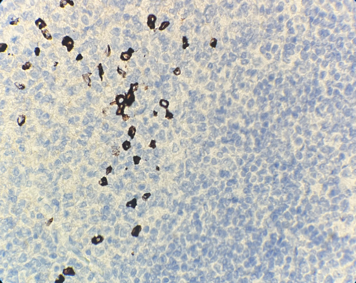 Marquage immunohistochimique anti-IgG4 — Dartmon