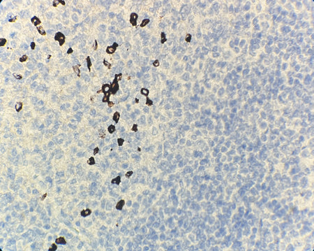 Marquage immunohistochimique anti-IgG4 — Dartmon