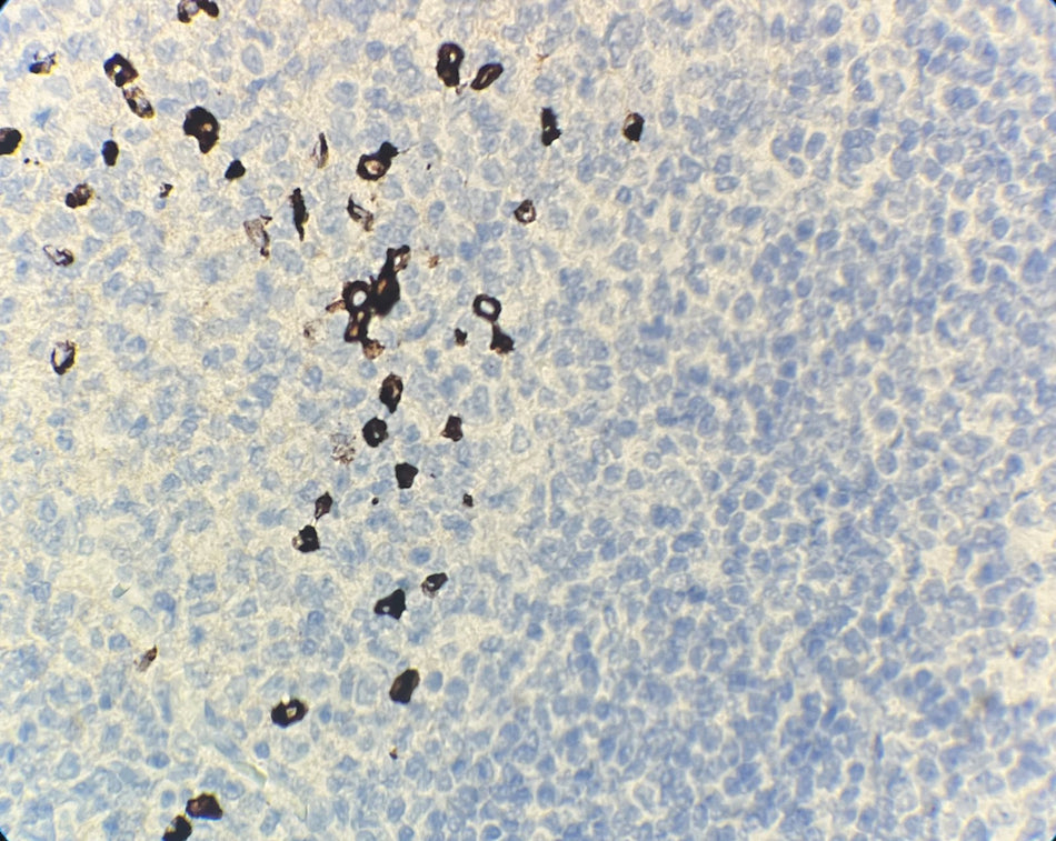 Marquage immunohistochimique anti-IgG4 — Dartmon