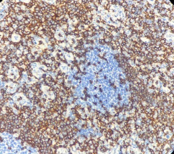 Marquage immunohistochimique anti-CD2 — Dartmon