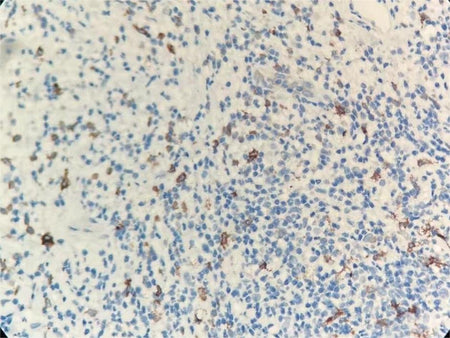 Marquage immunohistochimique anti-CD163 — Dartmon