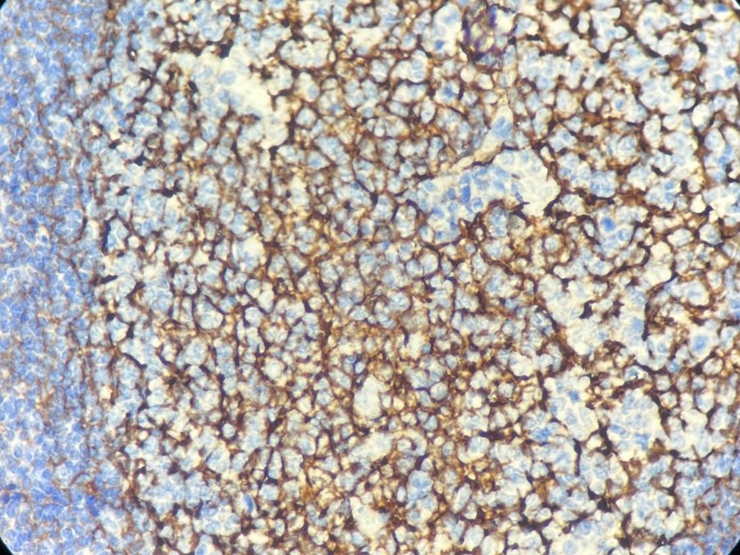 Marquage immunohistochimique anti-CD21 — Dartmon