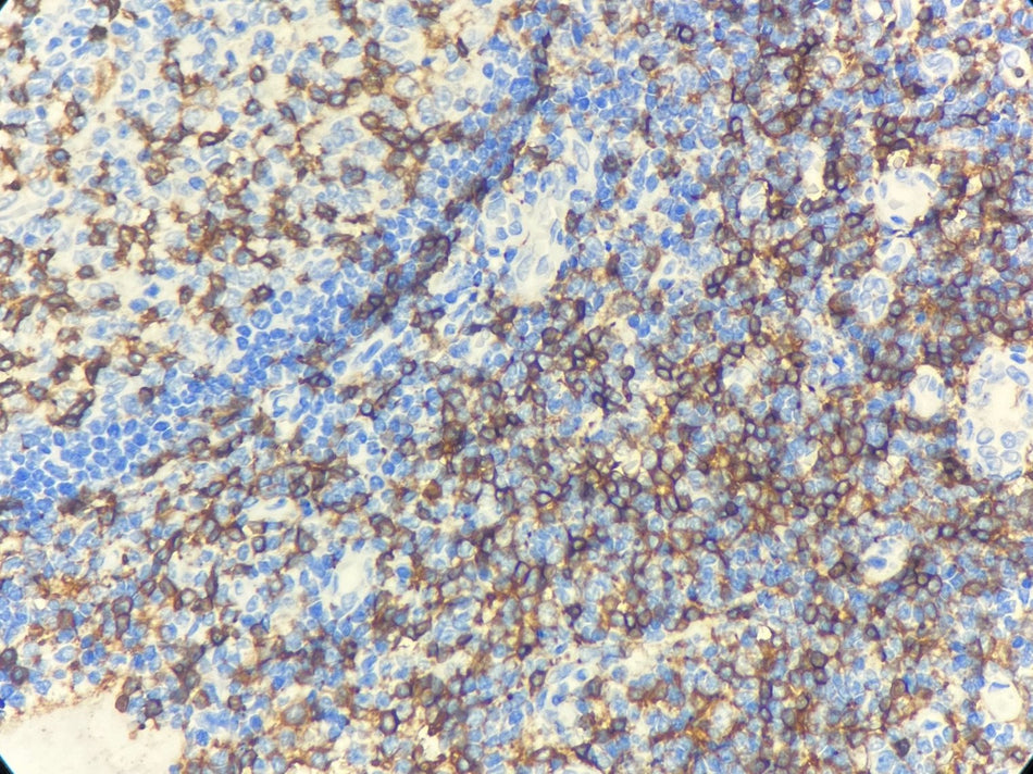Marquage immunohistochimique anti-CD4 — Dartmon