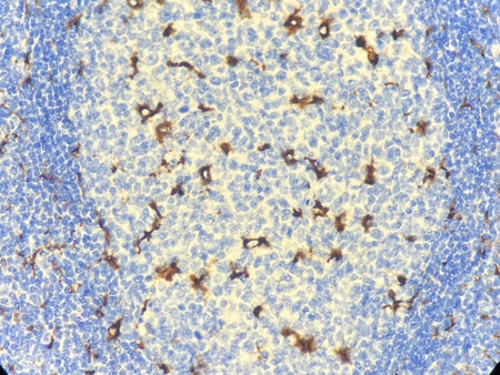 Marquage immunohistochimique anti-CD68 — Dartmon