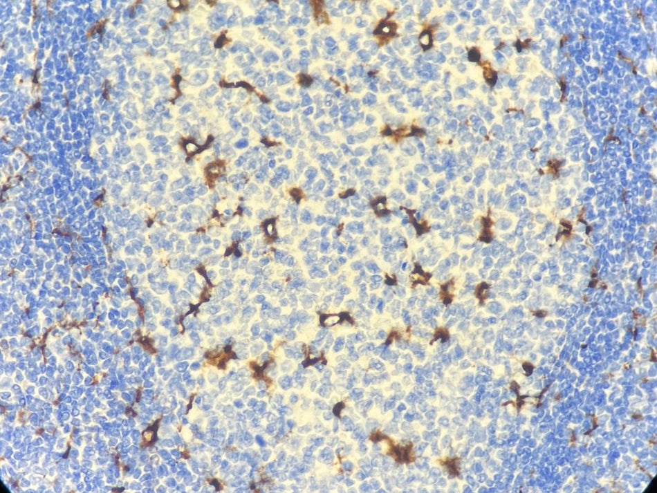 Marquage immunohistochimique anti-CD68 — Dartmon