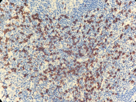 Marquage immunohistochimique anti-CD8 — Dartmon